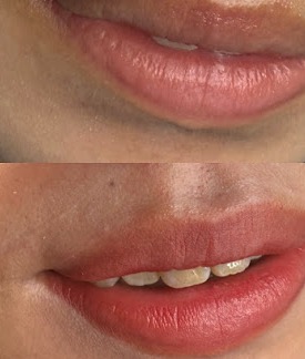 mdviy29ep3x3i2no2s9w-25d120d3.jpg